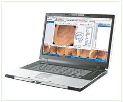 �Pӛ�����g���ϵ�y